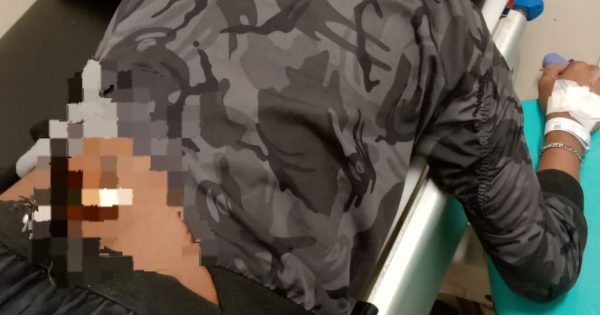 Polresta Palu Bubarkan Tawuran Geng Motor, 2 Diamankan 1 Terkena Panah