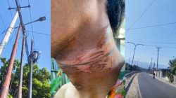 Kabel Provider Internet yang Semrawut “Jerat” Leher 2 Pemuda di Kota Palu